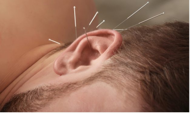 Kulak Akupunkturu: Faydası Çok, Yan Etkisi Yok